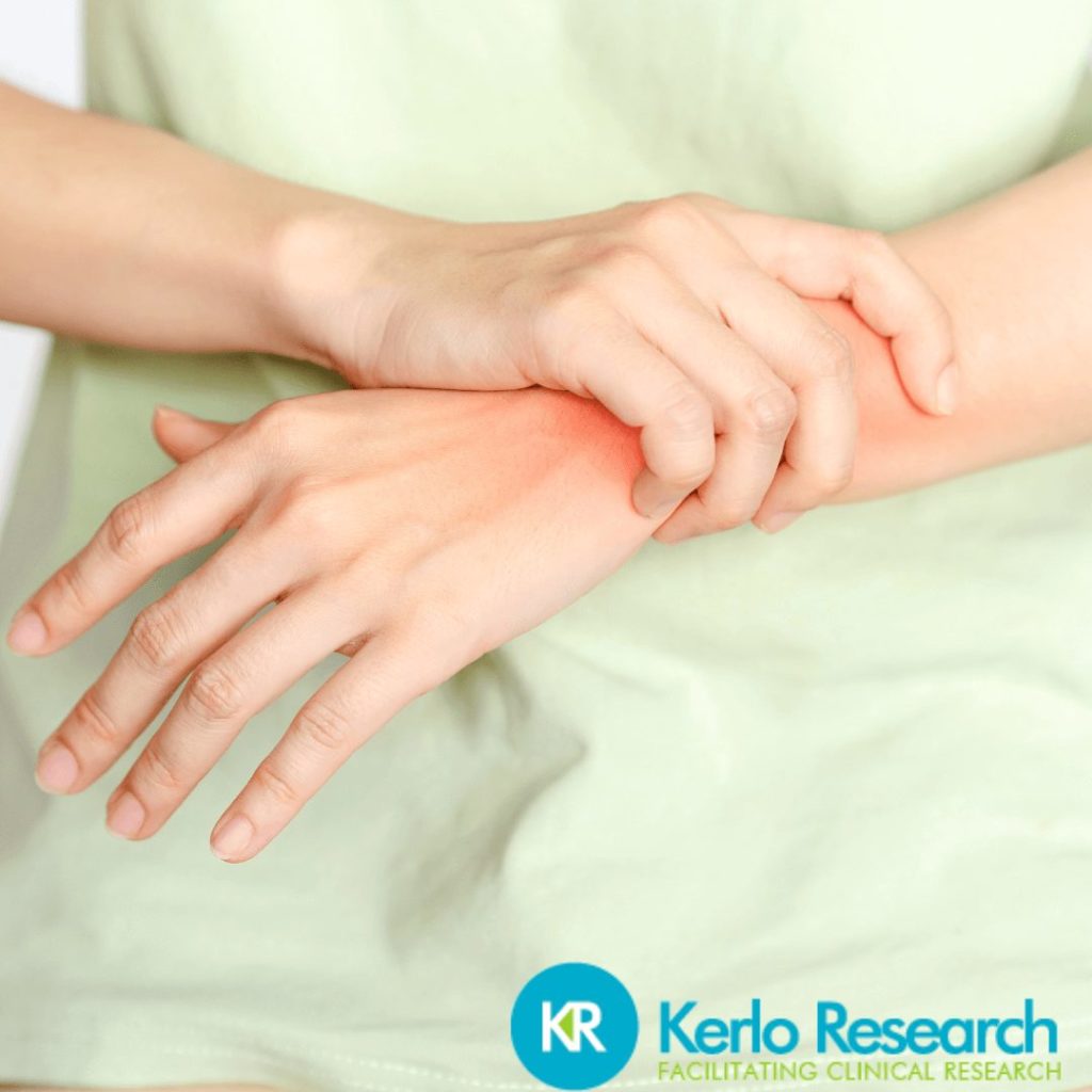 rheumatoid arthritis clinical study